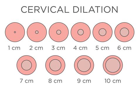 cervical dilation chart|how to tell if your cervix is dilating.